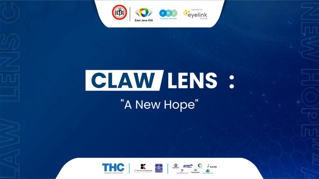 Claw Lens