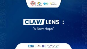 Claw Lens