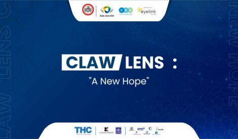 Claw Lens